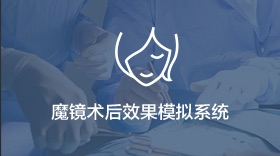 魔镜术后效果模拟系统