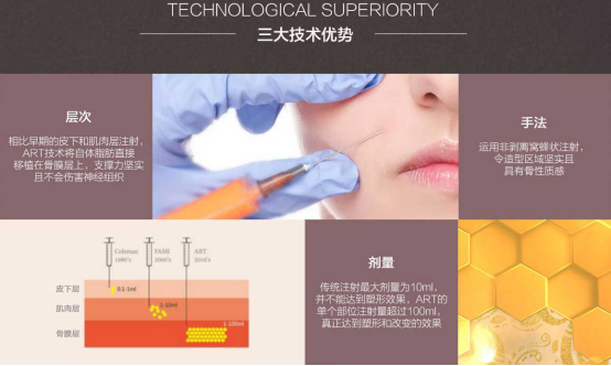 自体脂肪填充后会不会到处游走