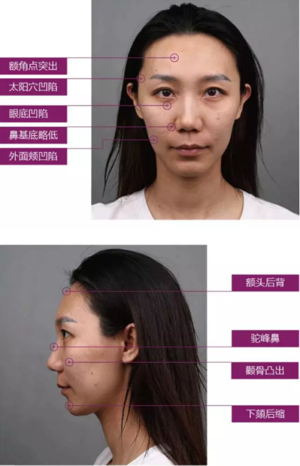 为变温柔做整形,全脸设计自己来