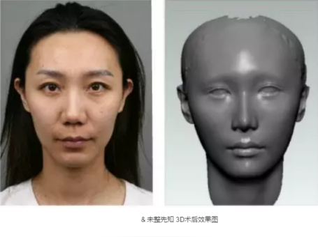 为变温柔做整形,全脸设计自己来