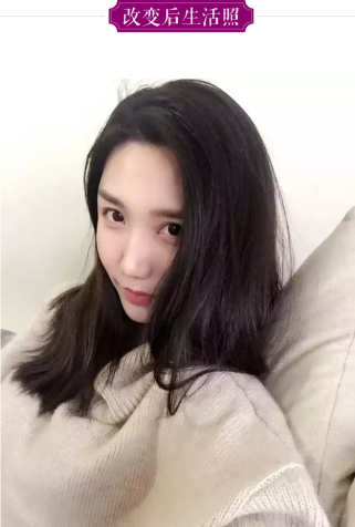 为变温柔做整形,全脸设计自己来