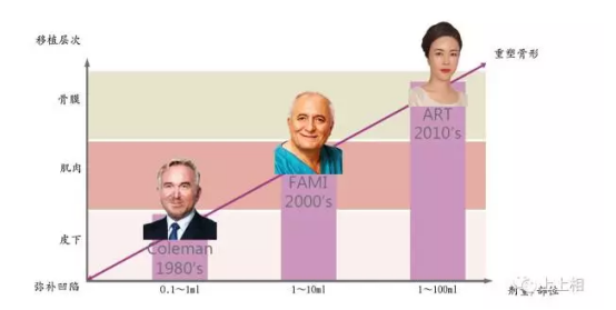 小手术、大效果-自体脂肪移植的ART技术