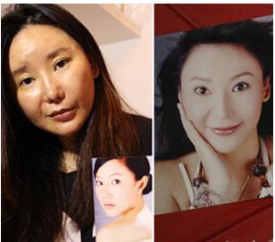 女子赴韩整容失败,面部严重变形